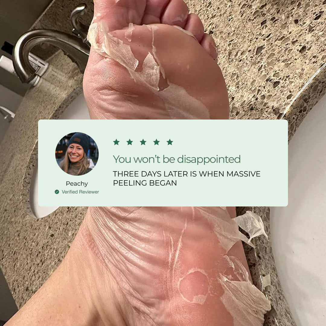 Peelology™ – The #1 Dermatologist-Tested Mask for Cracked Heels & Callus Removal