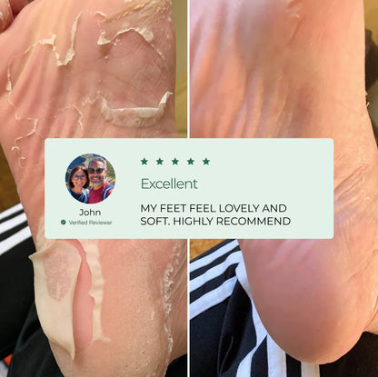 Peelology™ – The #1 Dermatologist-Tested Mask for Cracked Heels & Callus Removal